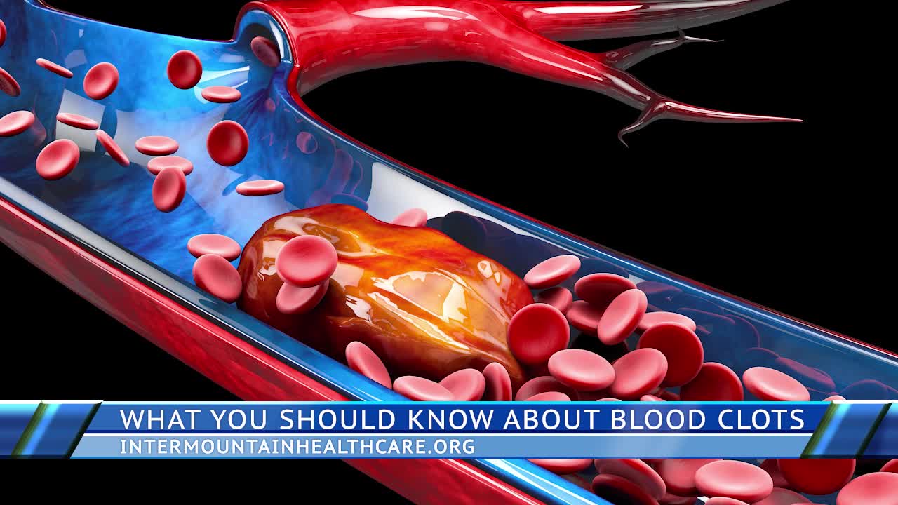 What Everyone Should Know About Blood Clots to Stay Safe